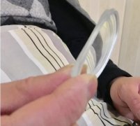 37岁罹患1200度近视并发白内障的患者在成都爱尔重见光明