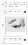 什么?!眼球突出眼睛肿痛居然是甲亢